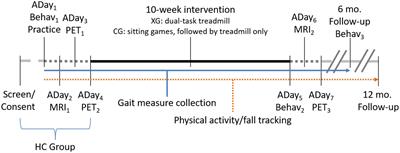 Changes in Metabolic Activity and Gait Function by Dual-Task Cognitive Game-Based Treadmill System in Parkinson’s Disease: Protocol of a Randomized Controlled Trial